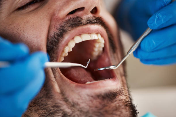 Best Cracked Tooth Emergency Dentist  in White Mountain Lake, AZ
